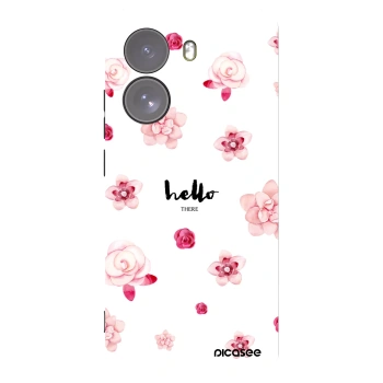 Picasee husă neagră din silicon pentru Xiaomi Poco X7 - Hello there