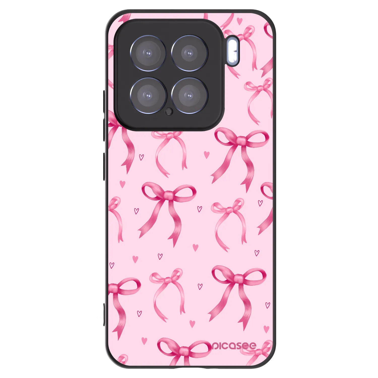 Picasee husă neagră din silicon pentru Xiaomi 15 - Bow Aesthetic