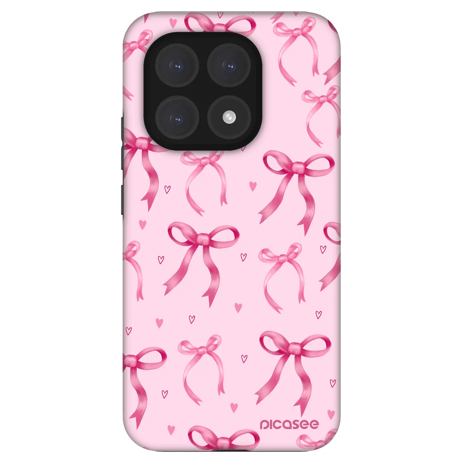 Picasee Fashion Case pentru Xiaomi 15T - Bow Aesthetic
