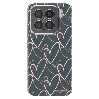 Picasee husă transparentă din silicon pentru Xiaomi 15 - Lots of love