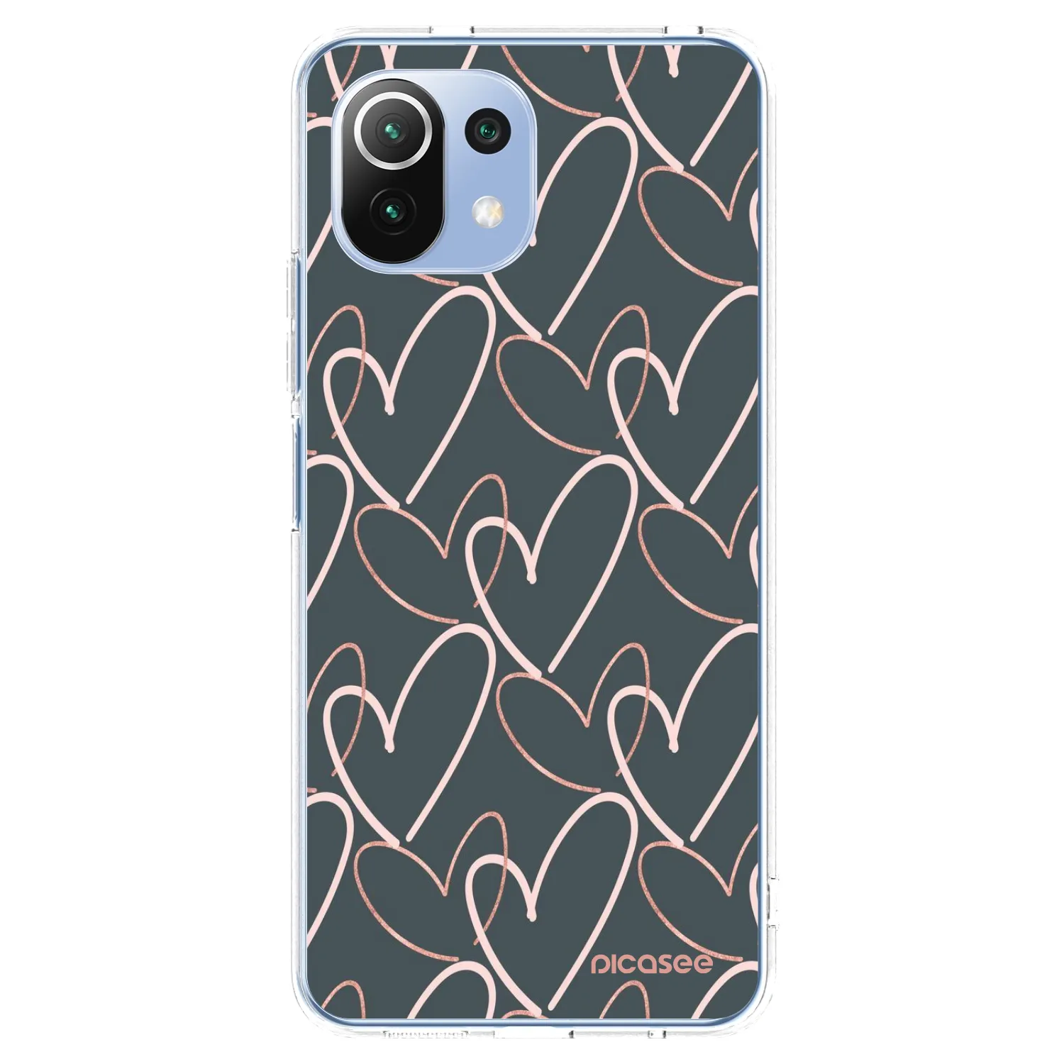 Picasee husă transparentă din silicon pentru Xiaomi Mi 11 Lite - Lots of love